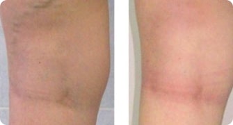 Resultado de Karina